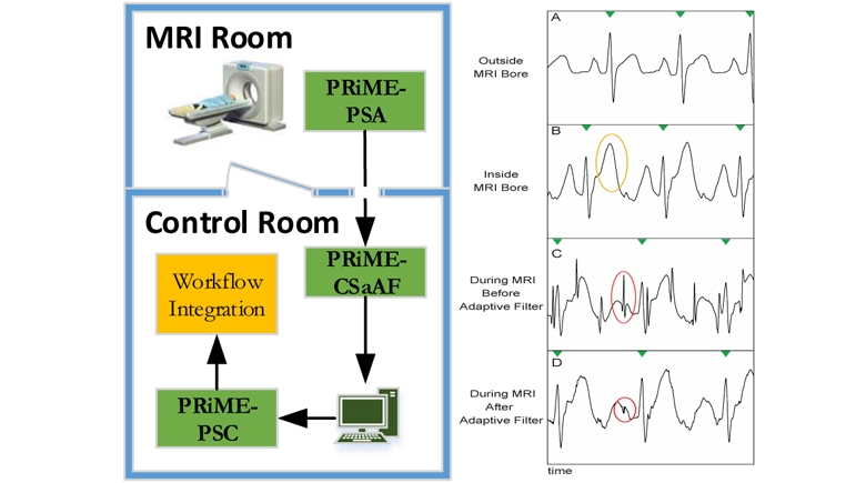 Physiological Recording in the MRI Environment (PRiME): MRI-Compatible Hemodynamic Recording System