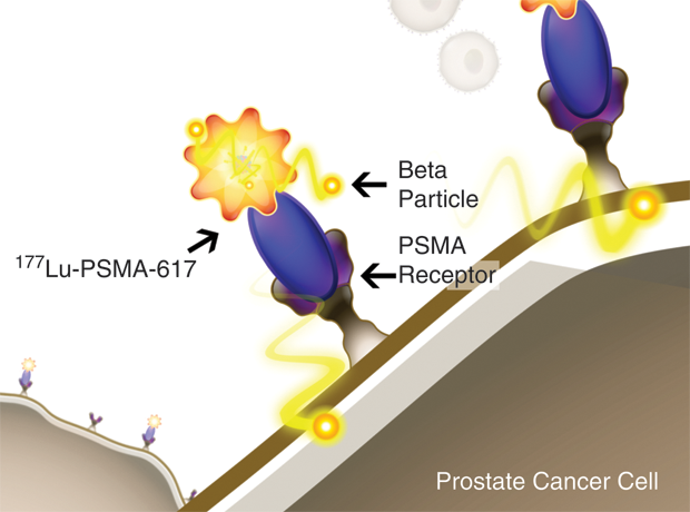 Figure 3: Endocyte obtained exclusive global rights to develop and commercialize PSMA-617, a highly promising agent for certain types of prostate cancer, specifically those that express PSMA. PSMA is found in more than three-quarters of patients who have metastatic castration-resistant prostate tumors. This illustration shows the radioligand therapeutic 177Lu-PSMA-617 binding to a PSMA-positive prostate cancer cell. (Image courtesy of Endocyte, Inc.)