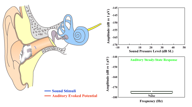 Ear-EEG-Based Objective Hearing Threshold Estimation Evaluated on Normal Hearing Subjects