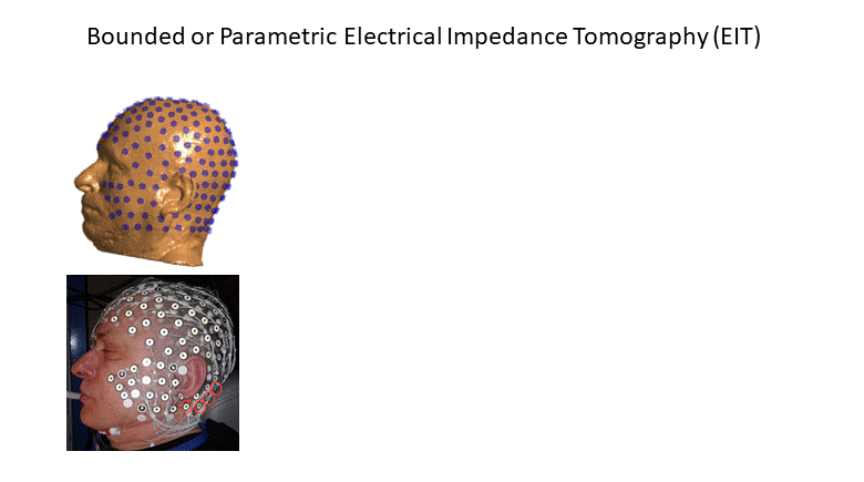 Skull Modeling Effects in Conductivity Estimates Using Parametric Electrical Impedance Tomography