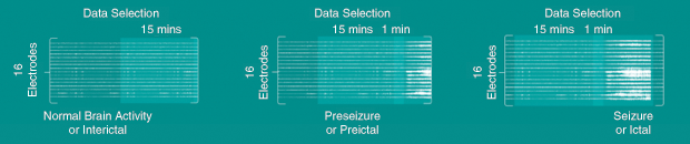 Figure 3: An example of brain activity data collected from an individual patient before and during a seizure. (Images courtesy of Stefan Harrer.)