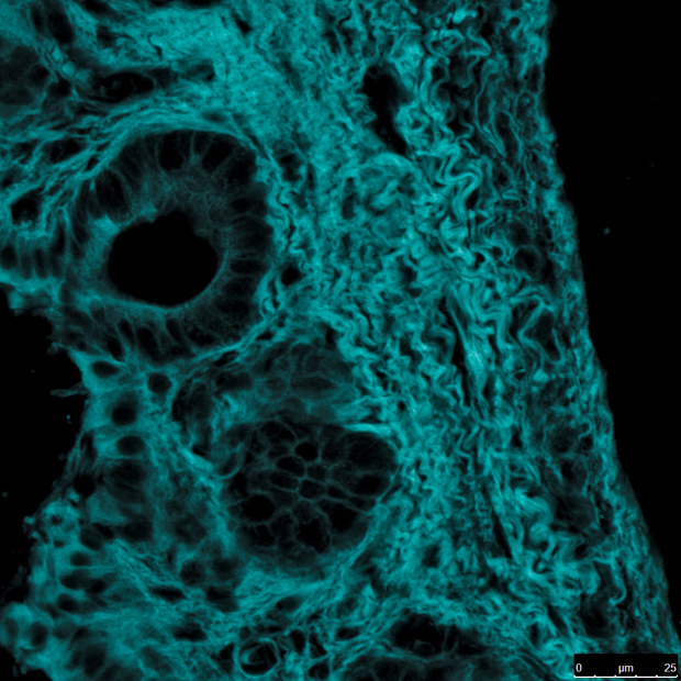 The interstitium in a rat extrahepatic bile duct, as captured by collagen second-harmonic generation microscopy.