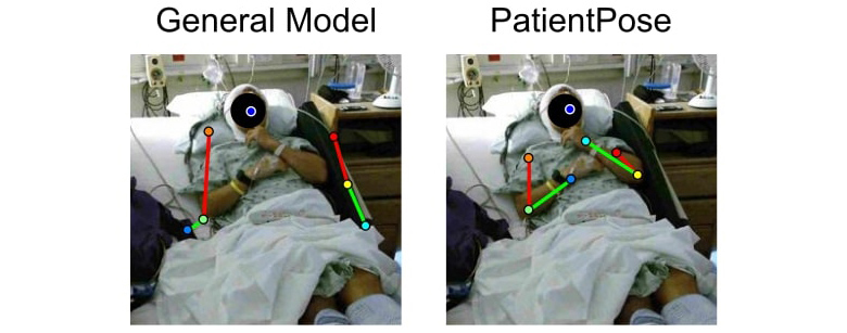 Patient-Specific Pose Estimation in Clinical Environments