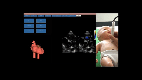 Virtual Neonatal Echocardiographic Training System (VNETS): An Echocardiographic Simulator for Training Basic Transthoracic Echocardiography Skills in Neonates and Infants