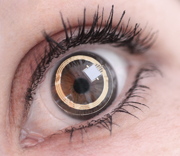 FIGURE 4: The Triggerfish lens fits in the eye like an ordinary contact lens. (Photo courtesy of Sensimed.)