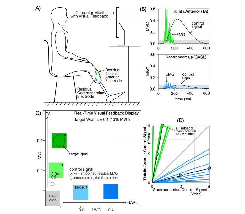 Voluntary Control of Residual Antagonistic Muscles in Transtibial Amputees: Feedforward Ballistic Contractions and Implications for Direct Neural Control of Powered Lower Limb Prostheses