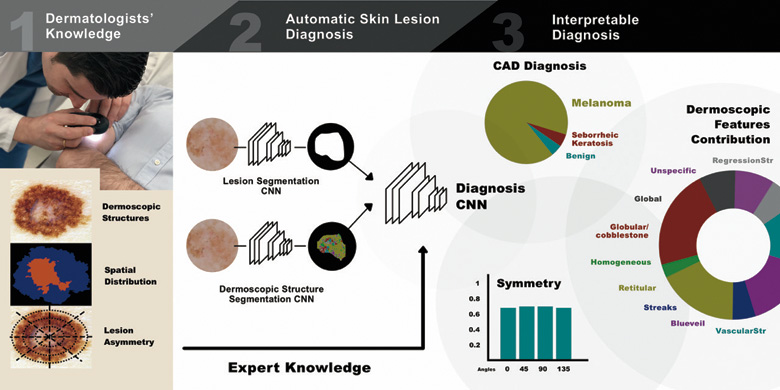 Special Issue on Skin Lesion Image Analysis for Melanoma Detection