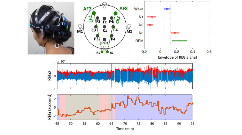 Transcranial Impedance Changes during Sleep: a Rheoencephalography Study