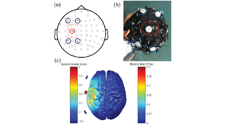 Graph Theory Analysis of Functional Connectivity in Major Depression Disorder with High-Density Resting State EEG data