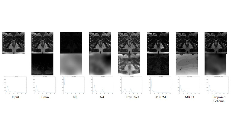 Context Dependent Fuzzy Associated Statistical Model for Intensity Inhomogeneity Correction from Magnetic Resonance Images 