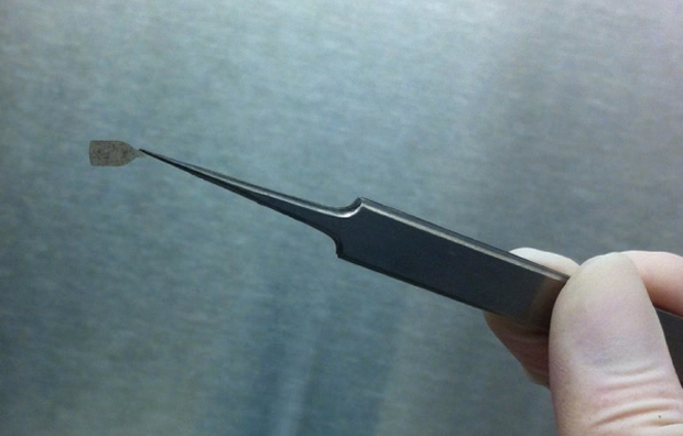 Figure 6. Humayun also designed a surgical tool to fold the 3.5 × 6 mm membrane patch (shown here); slide it through an implantation shaft that was about the diameter of a human hair; and then unfold it once it was in place within the eye. (Photo courtesy of Britney O. Pennington, PhD).