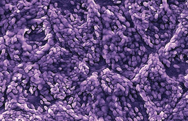 Figure 3. CPCB group is using stem cells to generate an RPE cell patch with the same anatomical configuration that occurs in a normal retina. This scanning electron microscope image shows the stem-cell-derived RPE cells. (Photo courtesy of USC Roski Eye Institute.)