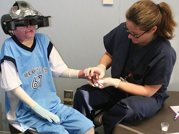 Figure 6. VR is used to distract a pediatric burn patient at Shriners Children Hospital, Galveston, TX, during the painful skin-stretching exercises of a physical-therapy session. These exercises are necessary to maintain skin elasticity and to maximize functionality after recovery. (Copyrighted photograph by Hunter Hoffman/www.vrpain.com.)