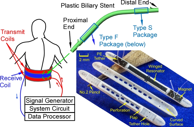 Encapsulation Approaches for In-Stent Wireless Magnetoelastic Sensors