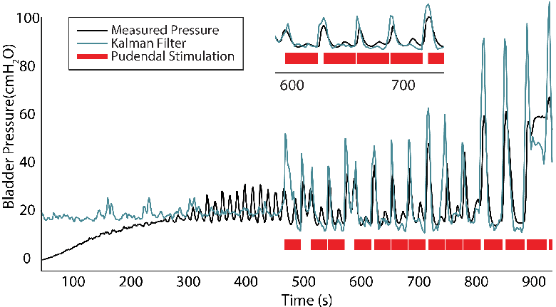 Real-Time Bladder Pressure Estimation for Closed-Loop Control in a Detrusor Overactivity Model