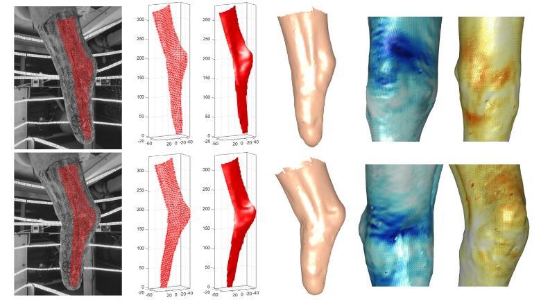 A Framework for Measuring the Time-Varying Shape and Full-Field Deformation of Residual Limbs Using 3D Digital Image Correlation