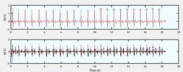Near Real-Time Implementation of An Adaptive Seismocardiography — ECG Multimodal Framework for Cardiac Gating