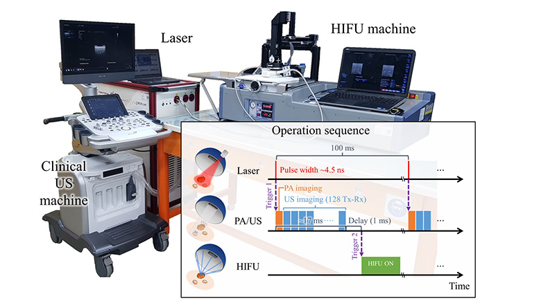 Real-Time Photoacoustic Thermometry Combined with Clinical Ultrasound Imaging and High-Intensity Focused Ultrasound