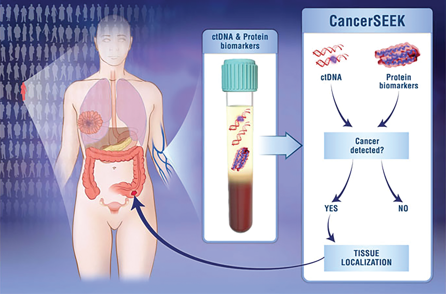 Figure 2. Designed to complement existing standard-of-care cancer screening methods, CancerSEEK detects genetic mutations (circulating tumor DNA or ctDNA) and protein biomarkers that are associated with the presence of multiple cancer types, and does it through a simple blood draw. (The tissue localization arrow in this graphic refers to a JHU retrospective study of 1,005 patients with one of eight cancer types, and demonstrated that a molecular test was able to localize the cancers to a small number of anatomic sites in 83% of patients. Details at https://hub.jhu.edu/2018/01/19/cancer-blood-test-johns-hopkins/.) (Image credit: Elizabeth Cook and Kaitlin Lindsay.)